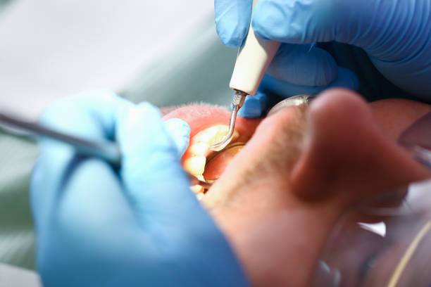 Best Emergency Dental Surgery in Chepachet, RI