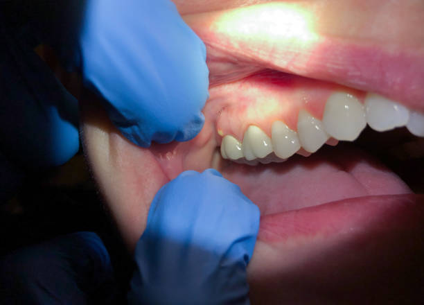 Best Emergency Dental Care for Trauma or Injury in Chepachet, RI