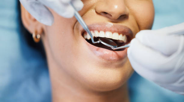 Best Emergency Tooth Extraction in Chepachet, RI