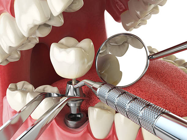 Best Emergency Treatment for Toothache in Chepachet, RI